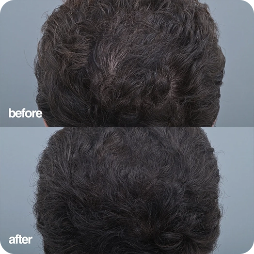 Anonymous before and after
