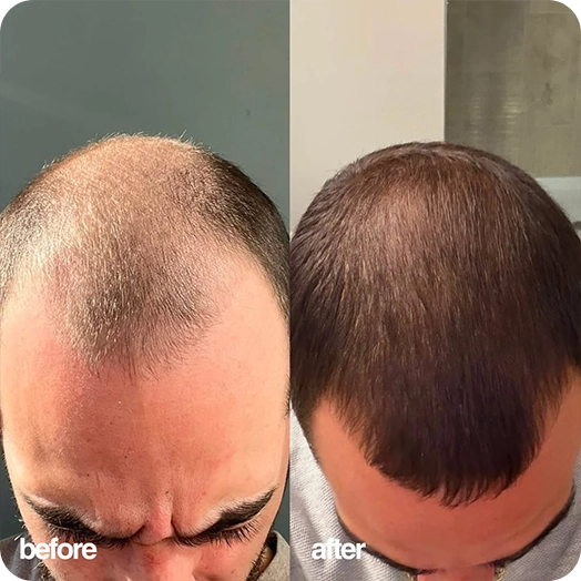 Anthony before and after