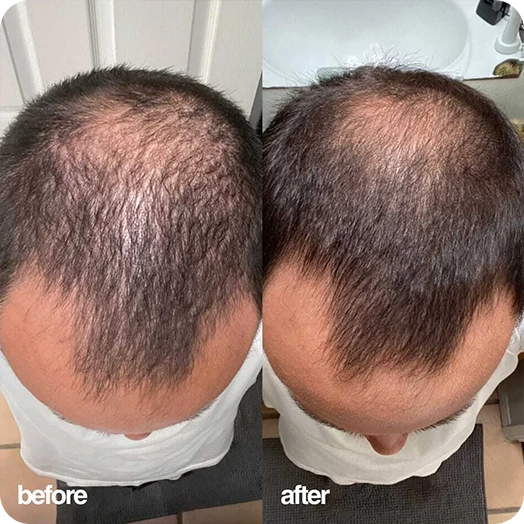 Chris before and after