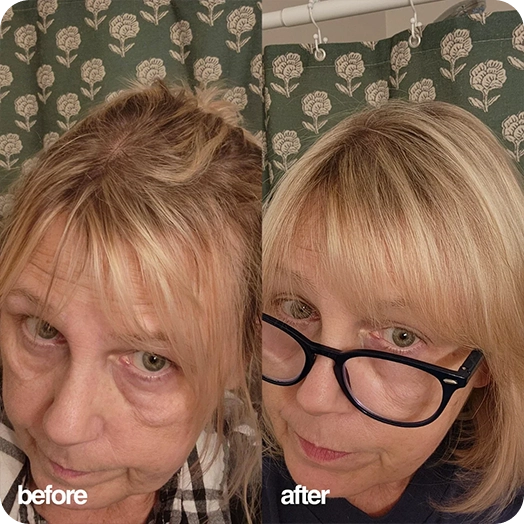 JoAnn before and after