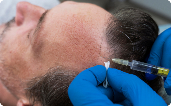 Linkov Hair Surgery