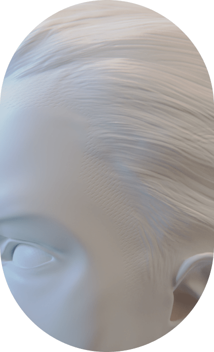 hair transplant for men nyc