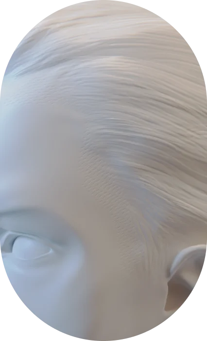 hair transplant for men nyc