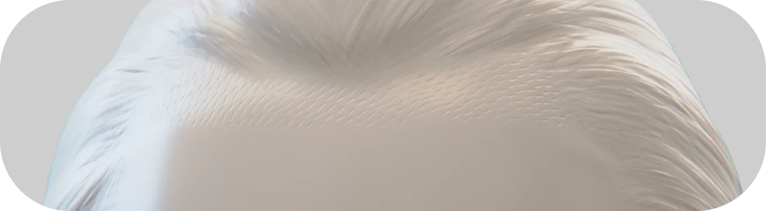 male hair transplant in Midtown Manhattan, NY