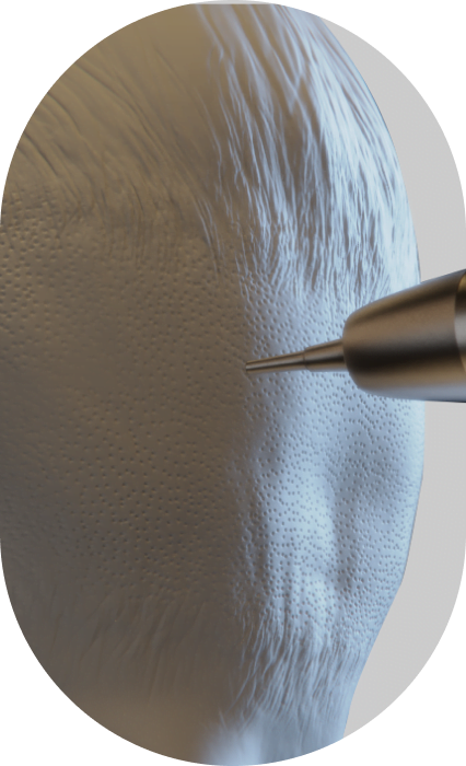 follicular unit extraction nyc