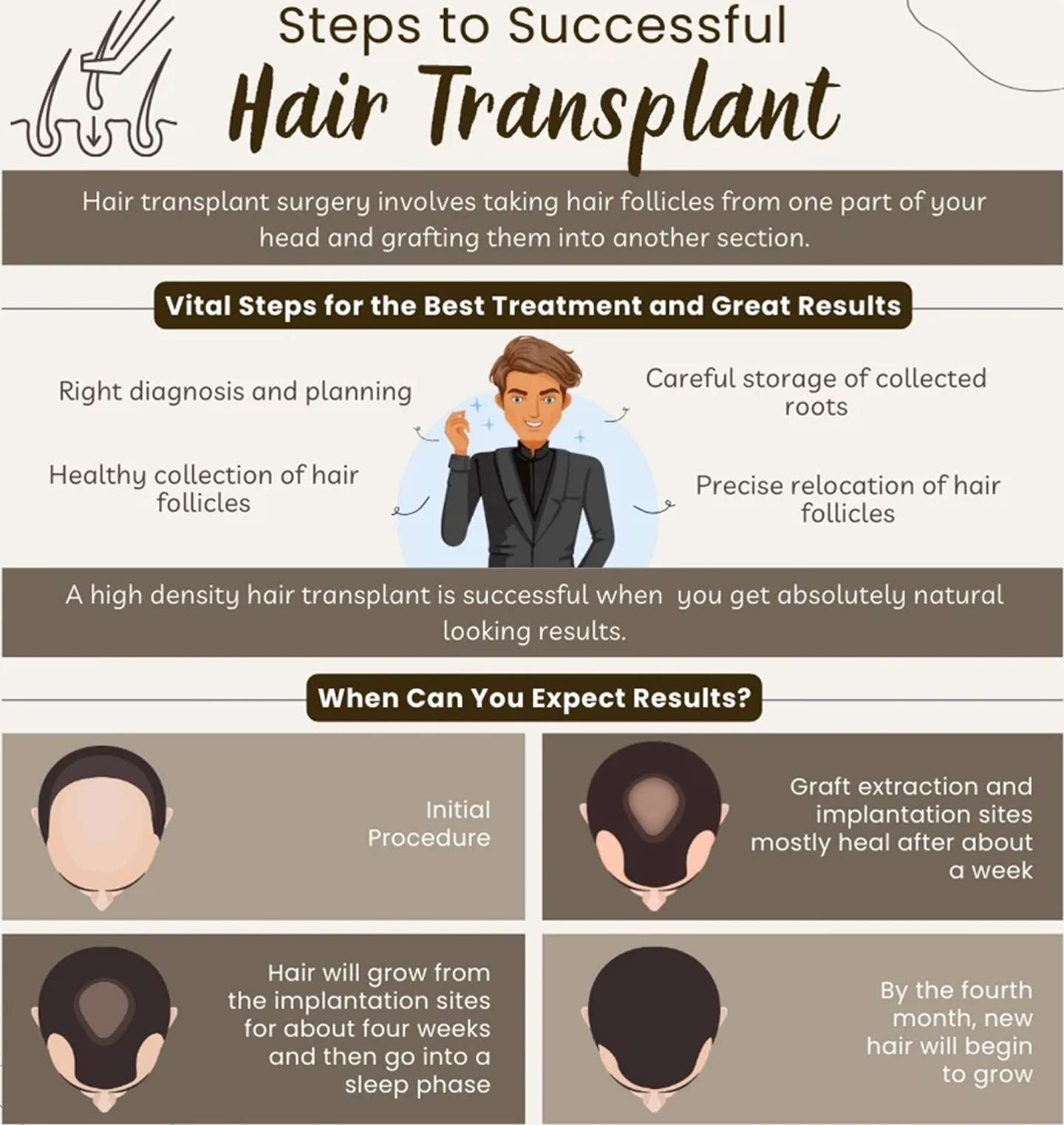 Steps To Successful Hair-Transplant